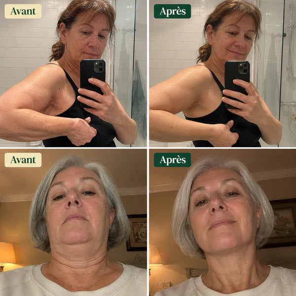 DRAINANT LYMPHATIQUE NUVAÉ®